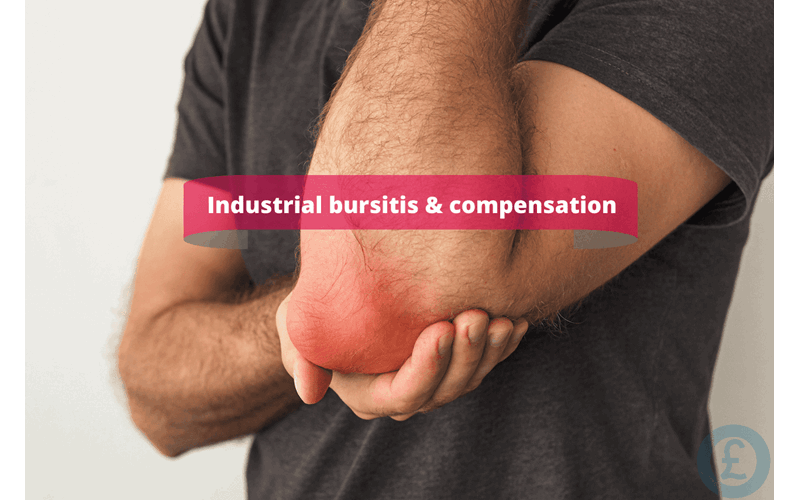 Money Savings Advice Industrial bursitis & compensation